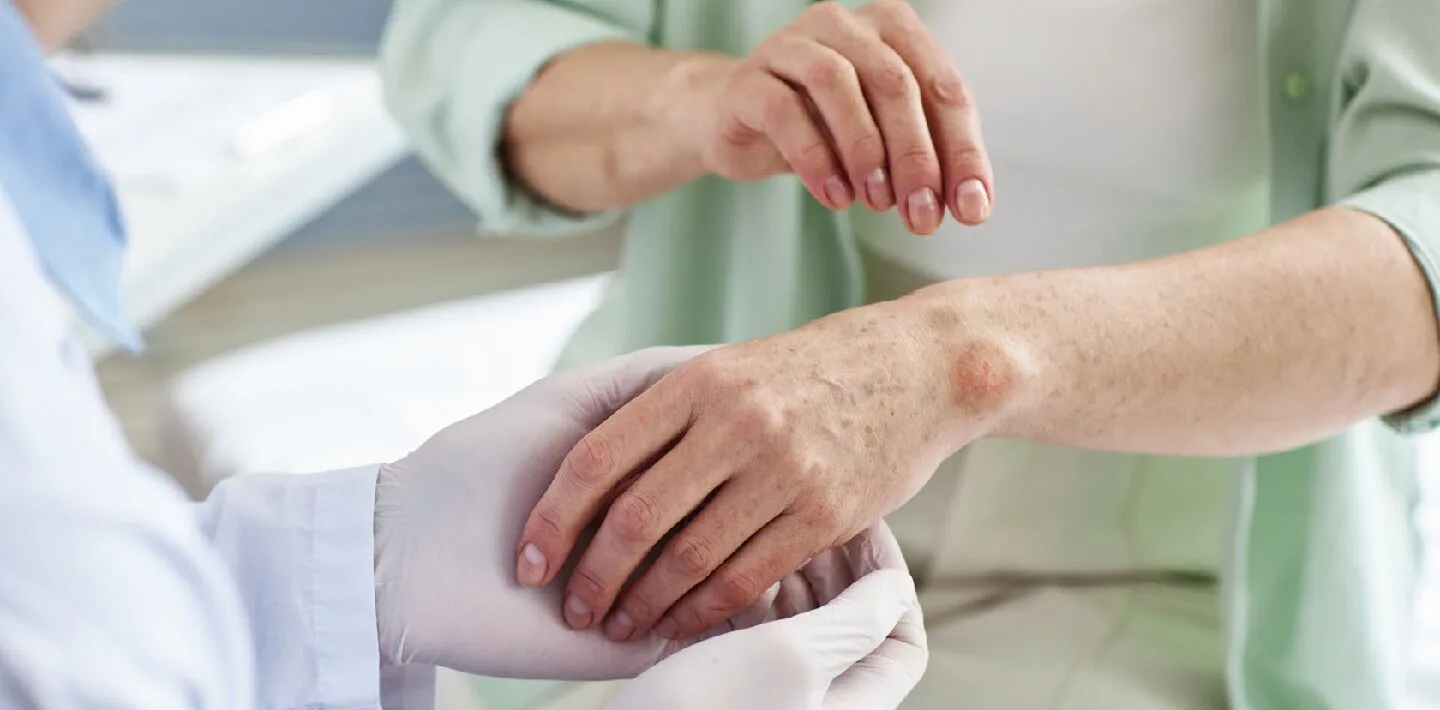 Rheumatology and Autoimmune Diseases